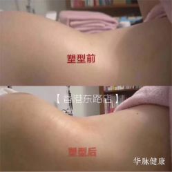 -华脉瘦身