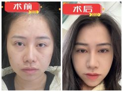 -素美医疗美容·西南眼鼻整形·修复基地