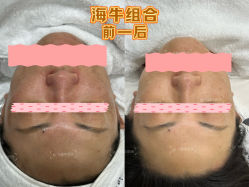 -海菲秀·飞顿牛奶光·LDM官方授权中心美轮美浣瓷感美肌