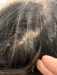 -熙朵美学植发·连锁品牌