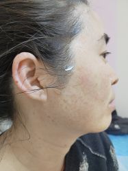 -长沙雅美医疗美容医院