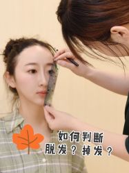 -碧莲盛·不剃发植发