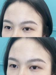点击看大图 -杨益美学·野生眉半永久纹眉发际线