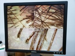-章光101防脱养发荟