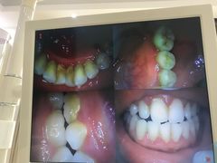 -赫尔森口腔·牙齿种植修复