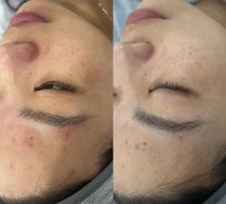 点击看大图 -SKIN79皮肤管理中心