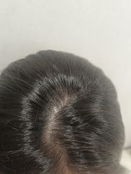 -熙朵美学植发·连锁品牌