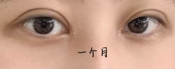 -JustHer宁波珈禾医疗美容医院