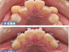 -团圆口腔·种植中心(锦江院区)