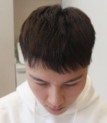 -大麦微针植发全国连锁