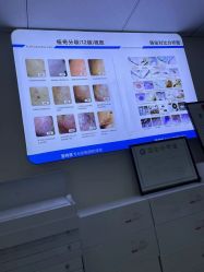 -蕾特恩专业祛痘