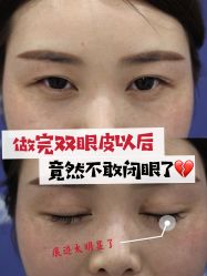 -Yestar宁波艺星整形医院