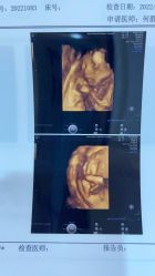 -济南艾玛妇产医院