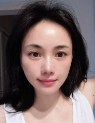 体验后-石家庄苏亚美联臣医疗美容医院