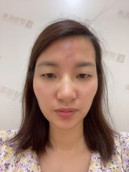 点击看大图 体验前-广州健丽·去眼袋医疗美容机构