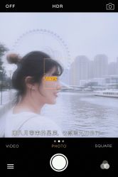 体验后-Yestar宁波艺星整形医院