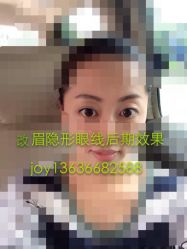 iphone_upload_pic-百秀名媛纹绣美学护肤中心