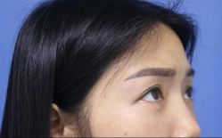 -天津健丽·去眼袋医疗美容机构