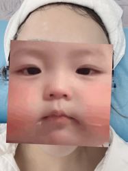 -小忠丽格医美
