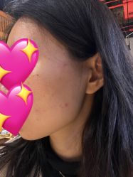 体验后-南京医科大学友谊整形外科医院