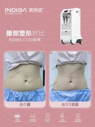 -半岛故事·法儿曼抗衰·indiba中心