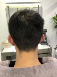 -熙朵美学植发·连锁品牌