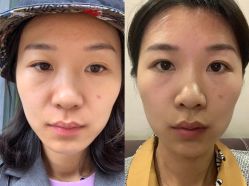 -溢美古法抗衰