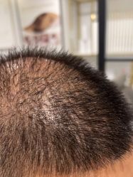 -熙朵美学植发·连锁品牌