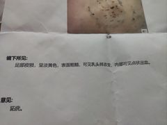 -重庆医科大学附属第一医院(本部)