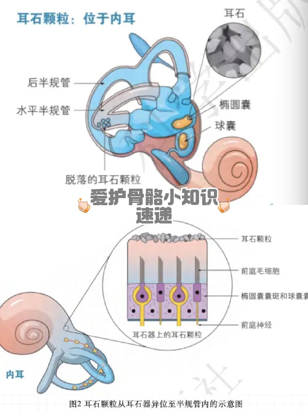 带您简单了解耳石症