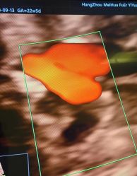 -杭州贝瑞斯美华妇儿医院·早孕·产检·儿科