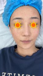 体验后-深圳阳光医疗美容