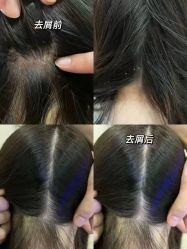 -希梵尔头皮抗衰·科技养发