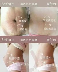点击看大图 -橘西产后康复中心