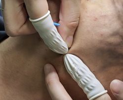 -宜肤清颜专业祛痘问题肌修护