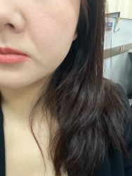 体验后-深圳阳光医疗美容医院·旗舰店
