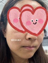 体验前-SKINIST丽铂医疗美容