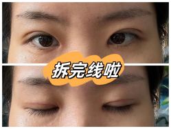-素美医疗美容·西南眼鼻整形·修复基地