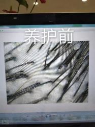 点击看大图 -新生植发·植养护一体