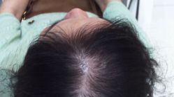 -雍禾植发全国连锁