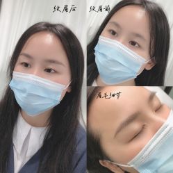 -久匠半永久纹眉