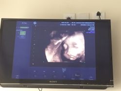 -杭州贝瑞斯美华妇儿医院·早孕·产检·儿科