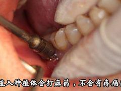 -团圆口腔·种植中心(锦江院区)