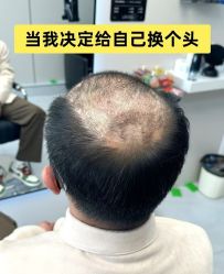 -唐风采假发补发定制