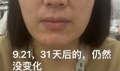 体验后-美莱医疗美容医院