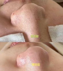 -克丽缇娜
