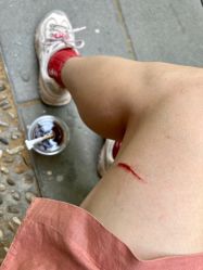 -明星刺青·洗纹身