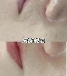 -智丽佳人祛斑祛痘美容美体