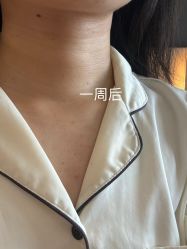 体验后-武汉五洲整形外科医院