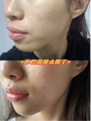 -新美荟医美·专注面部美学抗衰